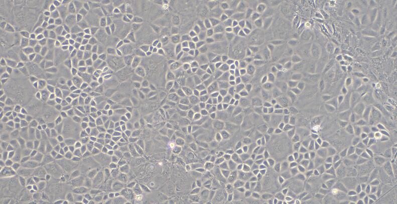 Primary Mouse Thymic Epithelial Cells (TEC)