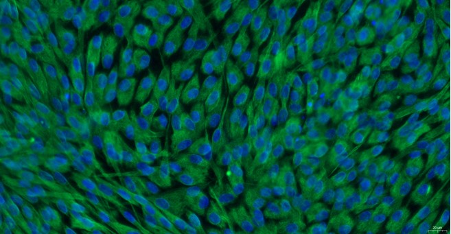 Primary Feline Pericardial Fibroblasts (PF)