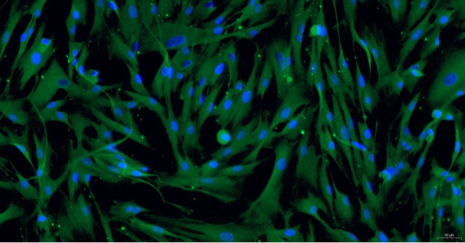 Primary Cavia Aortic Smooth Muscle Cells (ASMC)
