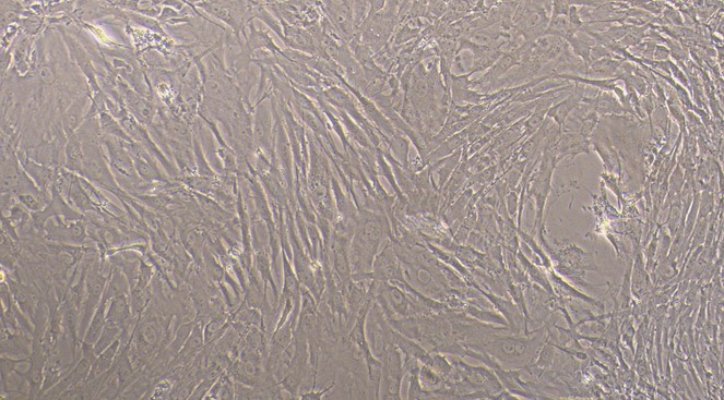 Primary Rabbit Aortic Smooth Muscle Cells (ASMC)