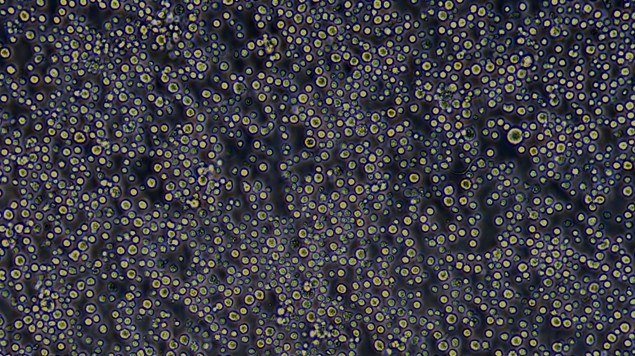 Primary Rabbit Bone Marrow Mononuclear Cells (BMMC)