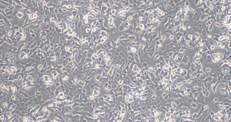 Human Prostate Cancer Cells (PCC)