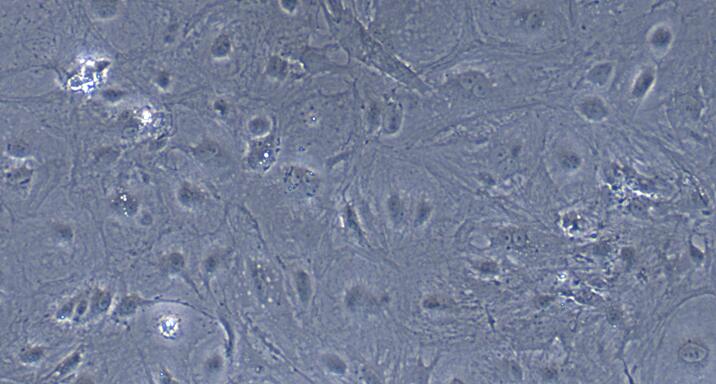 Primary Rabbit Placental Mesenchymal Stem Cells (PMSC)