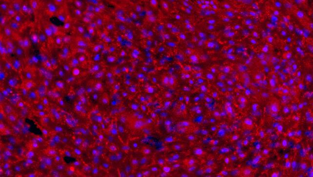 Primary Mouse Peritoneal Mesothelial Cells (PMC)