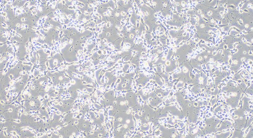 Primary Mouse Cerebral Cortex Neuron Cells (CCNC)