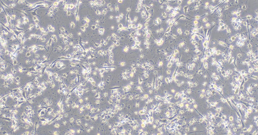 Primary Rat Cerebral Cortex Neuron Cells (CCNC)