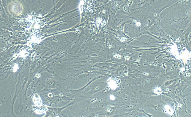 Primary Mouse  Amniotic Mesenchymal Stem Cells (AMSC)