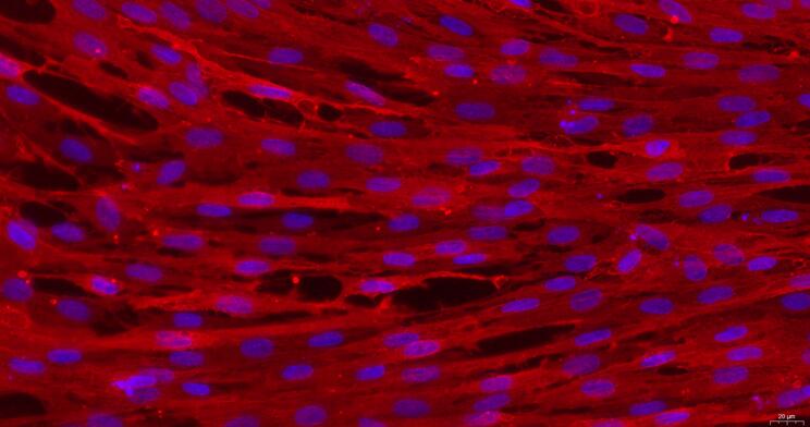 Primary Rabbit Vaginal Smooth Muscle Cells (VSMC)