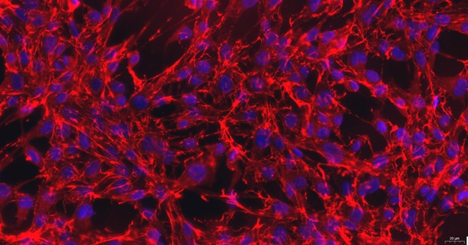 Primary Rat Aorta Adventitial Fibroblasts (AAF)