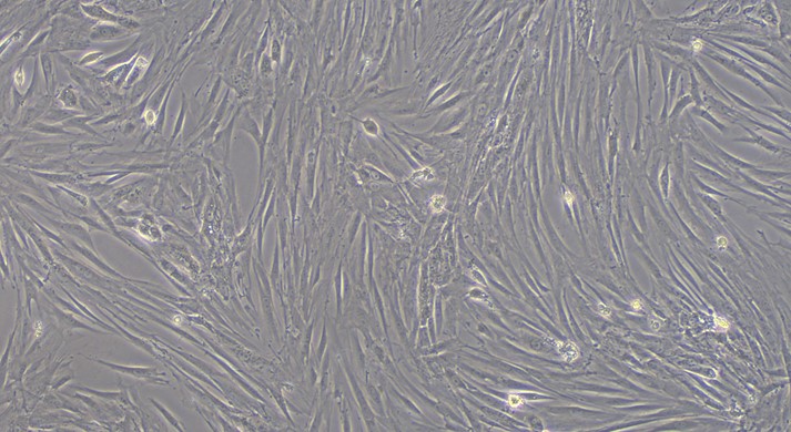 Primary Feline Epididymal Smooth Muscle Cells (EpSMC)
