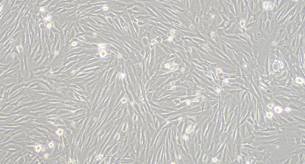 Primary Rabbit Epididymal Smooth Muscle Cells (EpSMC)