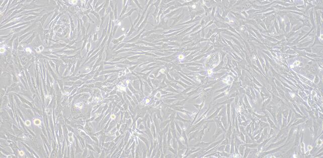 Primary Rabbit Seminal Vesicle Smooth Muscle Cells (SVSMC)