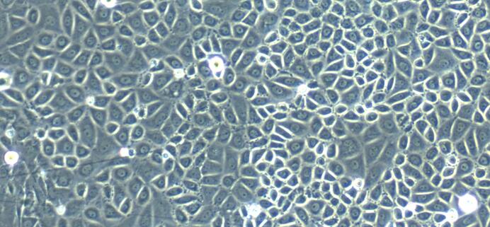 Primary Rat Pleural Mesothelial Cells (PlMC)