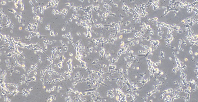 Primary Rat Olfactory Bulb Neuron Cells (OBNC)