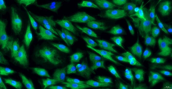 Primary Canine Peripheral Sciatic Nerve Fibroblasts ( PSNC)