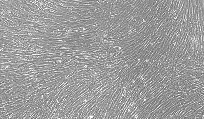 Primary Feline Peripheral Sciatic Nerve Fibroblasts ( PSNC)