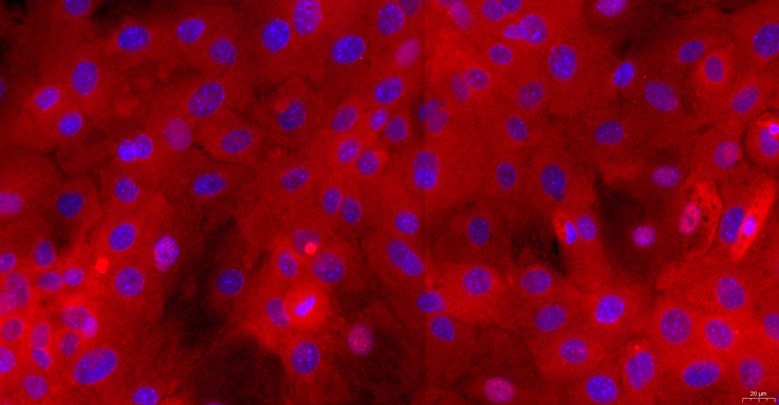 Primary Mouse Lingual Epidermal Cells (LiEC)