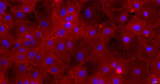 Primary Rabbit Lingual Epidermal Cells (LiEC)