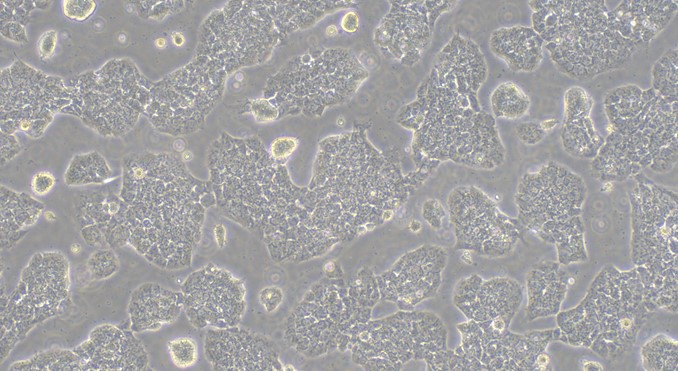 Human A-673 Rhabdomyoma Cells (A-673)