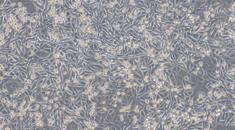 Human SW480 Colon Carcinoma Cells (SW480)