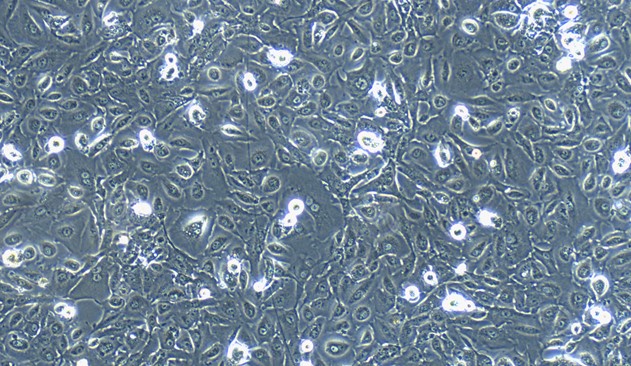 Human OS-RC-2 Renal Cancer Cells (OS-RC-2)