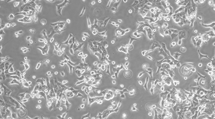 Human CFPAC-1 Pancreatic Cancer Cells (CFPAC-1)