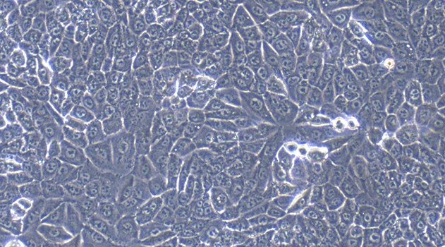 CSI399Hu11.jpg