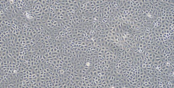 Rat WB-F344 Hepatic Stellate Cells (WB-F344)