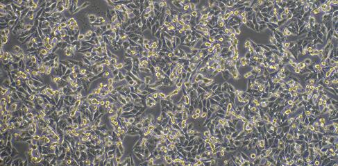 Human A-375 Melanoma Cells (A-375)