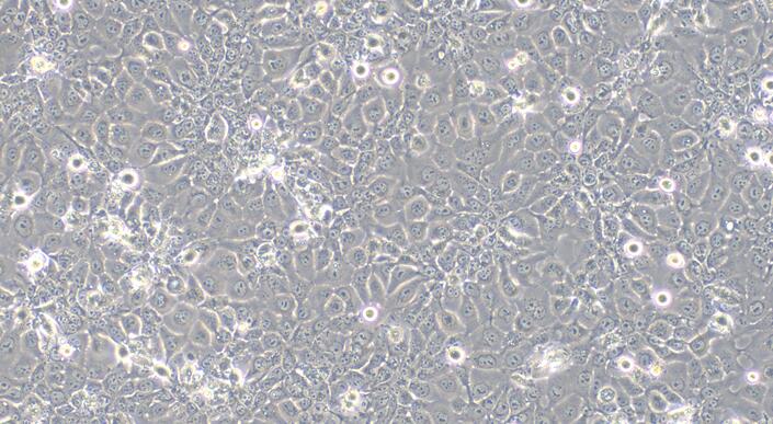 Human Kyse150 Esophageal Squamous Cell Carcinoma Cells (Kyse150)