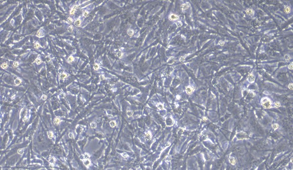 CSI461Hu11.jpg