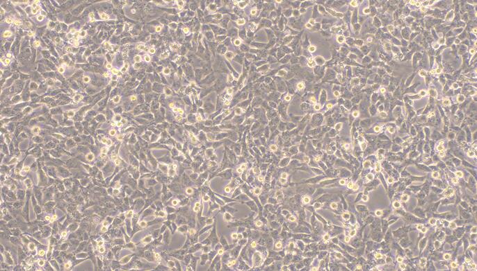 Human WPMY-1 Normal Prostate Stromal Immortalized Cells (WPMY-1)