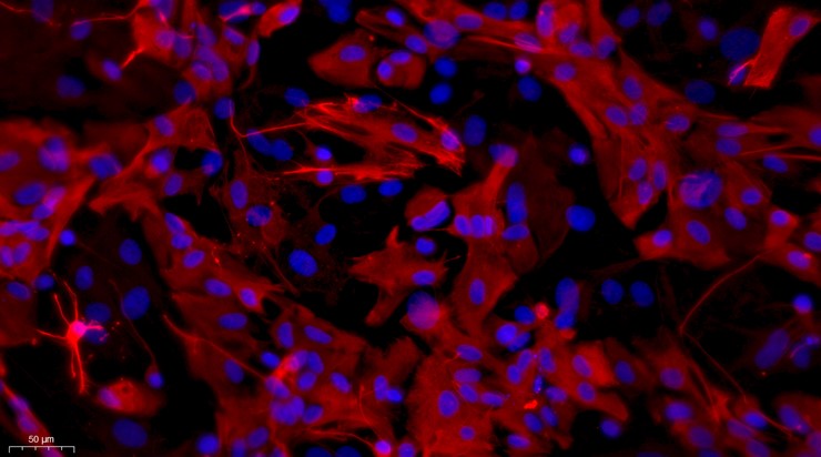 Primary Mouse Optic Nerve Astrocytes (ONA)