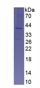 Eukaryotic Glial Cell Line Derived Neurotrophic Factor (GDNF)