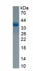 Eukaryotic Insulin Like Growth Factor 2 (IGF2)