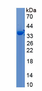 Eukaryotic Insulin Like Growth Factor Binding Protein 4 (IGFBP4)