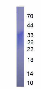 Eukaryotic Interleukin 13 (IL13)