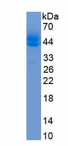 Eukaryotic Monocyte Chemotactic Protein 1 (MCP1)