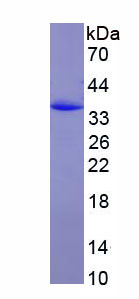 Eukaryotic Matrix Metalloproteinase 2 (MMP2)