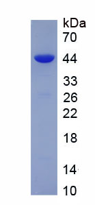 Eukaryotic Prostate Specific Antigen (PSA)