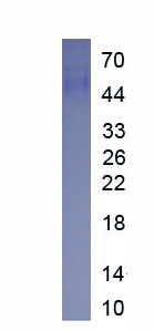Eukaryotic Alanine Aminotransferase (ALT)