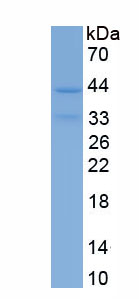 Eukaryotic Interferon Gamma Induced Protein 10kDa (IP10)