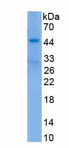 Eukaryotic Matrix Metalloproteinase 12 (MMP12)