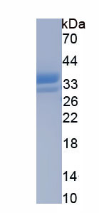 Eukaryotic Immunoglobulin E (IgE)