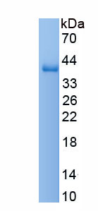 Eukaryotic Immunoglobulin A (IgA)