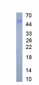 Eukaryotic Granzyme B (GZMB)
