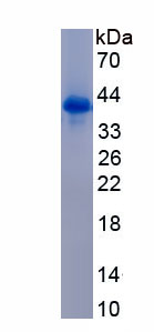 Eukaryotic Metallothionein 3 (MT3)