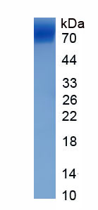 Eukaryotic Hypoxia Inducible Factor 1 Alpha (HIF1a)