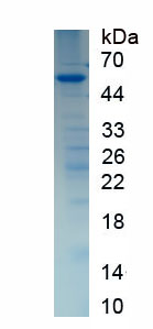 Eukaryotic C Reactive Protein (CRP)