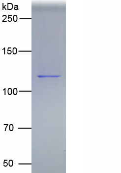 Eukaryotic Ceruloplasmin (CP)